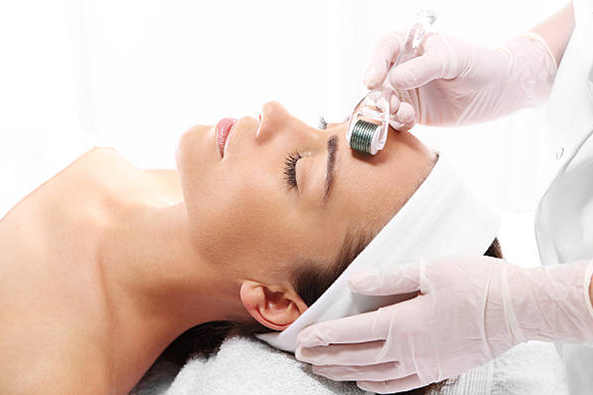 PRP med RF microneedling